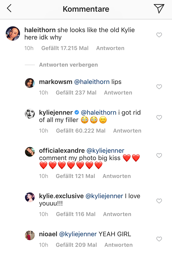 Kylie Jenner will jetzt tatsächlich auf ihre Lip-Filler verzichten und wir feiern das Ergebnis schon jetzt