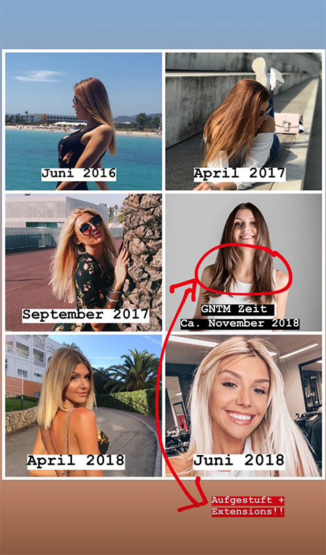 Gerda zeigt sich auf Instagram ohne ihre Extensions – und spricht offen über Haarausfall